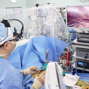 최소 절개, 빠른 회복 3D 완전내시경 심장수술 국내 첫 500례