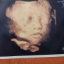 임신 28주 배크기, 입체초음파로 본 앵무 얼굴