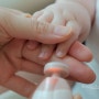 아기 손톱 상처 피 염증 안나게 자르기 필수템 콤비 신생아 네일트리머 추천