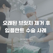 오래된 브릿지 제거 후 임플란트 치료 사례 <경기 광주 치과 추천>