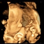 [임신기록] 임신 28주차 ~ 34주차 | 입체초음파 | 막달검사 | 평택 라헨느 산전마사지