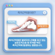 족저근막염 발바닥 발 통증 및 염증 한의원 치료