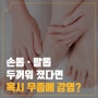 전염성 강한 발톱무좀 레이저 치료 통해 개선