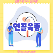 연골육종이란? 병태 생리, 증상, 진단 및 치료