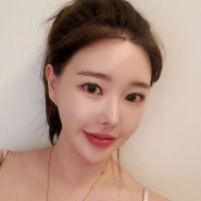 얼굴지방흡입, 프레쉬홍닥터의원에서 반전매력 외모로 변신!(가격,후기,전후,효과,잘하는곳,홍볼,홍턱)