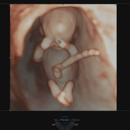 [9주~12주 임신기록]태아보험 가입/지인 임밍아웃/기형아검사/특수초음파
