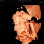 👶 임신중기 26주차-28주차 기록 (당화혈색소, 몸의 변화)