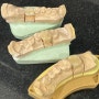 충치 치아 부러짐, 포스트 크라운 치아 치료하는 이유