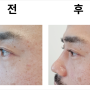 다이소 속눈썹 뷰러,집게 추천 남자 속눈썹 쉽게 올리기