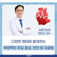 [건강정보] ‘천의 얼굴’ 부정맥, 증상부터 치료법까지