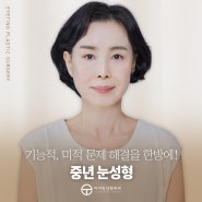 중년눈성형 하안검,상안검 수술로 효도 완료!