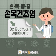 손목건초염 왜 엄지손가락이 아픈가요, 침산동 한의원 약침치료