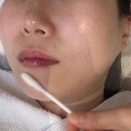 논현역 피부관리 삐땅기린뷰티센터 라라필 효과 미쳤던 후기