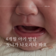 4개월 아기 발달 기록 :: 첫니가 나오려나 봐요!