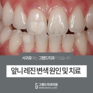 치아 착색 증상 앞니레진변색 떨어짐 재충치 발생