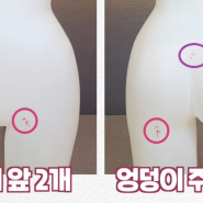 지긋지긋한 흉터! 흉터없이 가슴 수술하는 법은 없어?