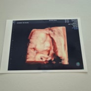 호박이 임신일기 25주 임산부 불면증 태동 산모교실 이사