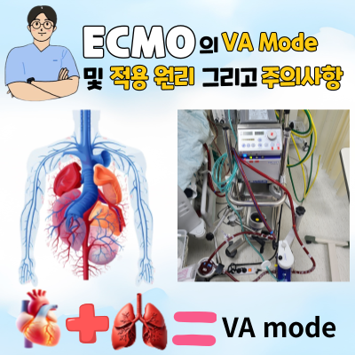 ECMO VA mode 적응증 및 적용 원리 ECMO VA mode 적용 시 주의사항 : 네이버 블로그
