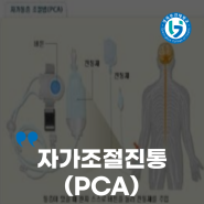 자가 조절 진통 (PCA)