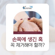 손목에 생기는 혹, 결절종! 꼭 제거해야할까?