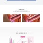 Vaginal Remodeling Laser, 이브로(Evero) 레이저