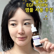 주름없애는 방법 수플로우 EGF PDRN 주름 탄력 앰플로 관리하기