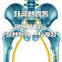 좌골신경통의 원인이 되는 질환들과 스트레칭 주의 사항