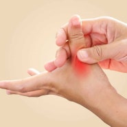 손가락 삐임에 대한 모든 것: 증상부터 치료, 재활 및 예방 방법까지영덕동헬스장, 흥덕PT,영덕동PT
