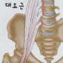 허리가 안펴지는 통증에는 장요근 먼저 체크합니다.