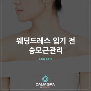 웨딩드레스 입기 전 승모근관리