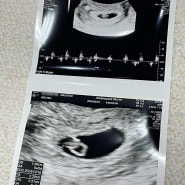 [임신기록 4-8주] 임신초기 여행 입덧 임신확인서 보건소