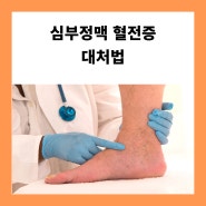 심부정맥혈전증 원인과 검사, 대처법