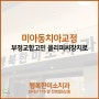 미아동치아교정 부정교합고민 클리피씨장치로