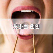 혓바늘 원인 및 빠르게 없애는법 면역 관리 팁!