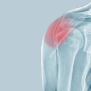오십견, 회전근개파열 어깨통증은 강남 어깨병원 전문 진료받으세요.