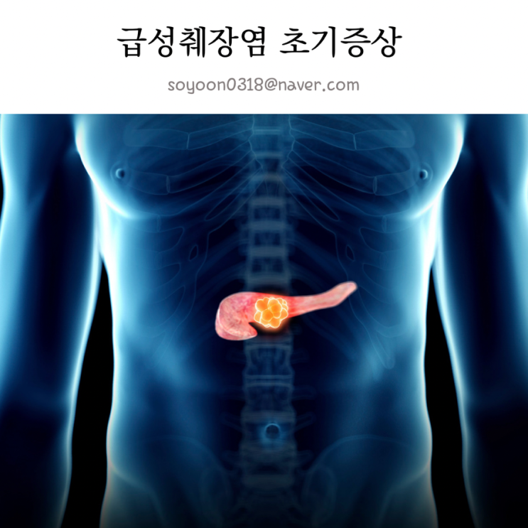 급성 췌장염 초기 증상 등가운데통증 명치통증 원인 치료! : 네이버 블로그
