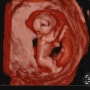 임신12주차 증상 각도법 도전 하이베베 성공 임산부 불면증 시작