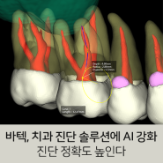 [보도자료] 바텍, 치과 진단 솔루션에 AI 강화한다