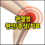 생활에 지장을 주는 관절염 원인 및 증상과 치료 방법