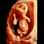 [임신12주차]임신 12주차 증상/1차 기형아검사 후기