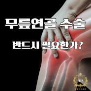 무릎연골 수술: 반드시 필요한가? 최신 연구와 비수술 치료법 탐구