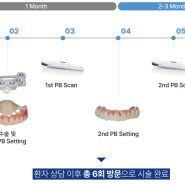 치주염으로 치아가 흔들려요 어떡하죠? 전체 임플란트 디지털 풀아치 2부 [부산역 뉴튼치과]