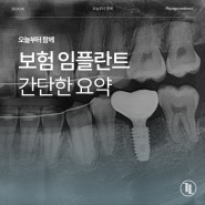 건강보험 임플란트, 보기 쉽게 정리해봤습니다!