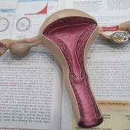 자궁경부이형성증 수술과 비수술 비교 및 선택의 기준은 바로 이 증상!!!