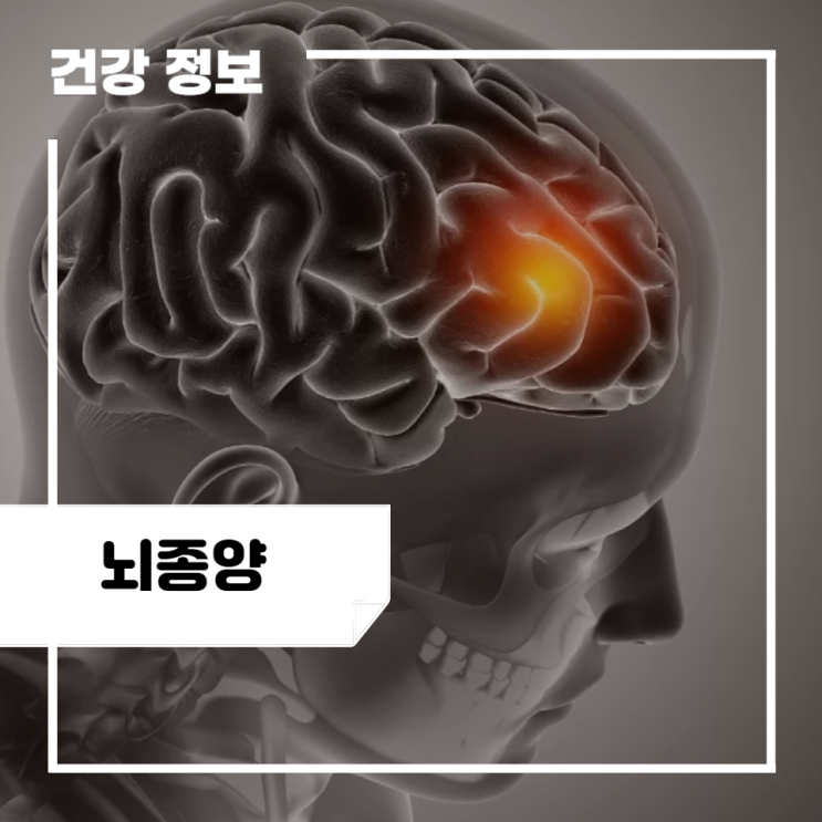 뇌종양 전조증상 및 원인, 치료 방법 : 소아 뇌종양 초기증상 : 네이버 블로그