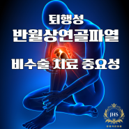 퇴행성 반월상연골파열 비수술 치료 중요성; FIDELITY 연구를 통해 알아보자