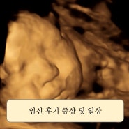 [임신 33~35주] 아기빨래 시작, 막달검사(대전미즈제일여성병원, 비용, 검사내용)