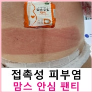 맘스 안심 팬티 접촉성 피부염 접착제 알러지 결과는?