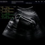 임신일기 29주차 6일 검진- 백일해접종(남편도) 몸무게변화, 꼬리뼈통증, 손발붓기