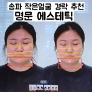 [송파경락] 송파 경락마사지 잘하는 곳 작은얼굴경락 만족한 후기 <명문 에스테틱>